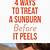 how to heal a sunburn fast