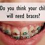 how to know if you need braces test