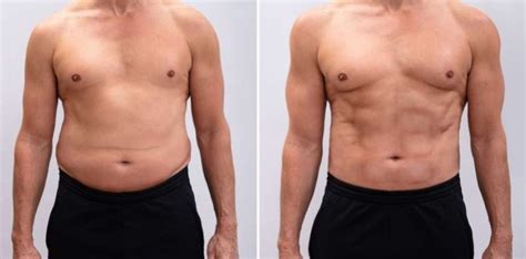 how to lose belly fat in a week for men