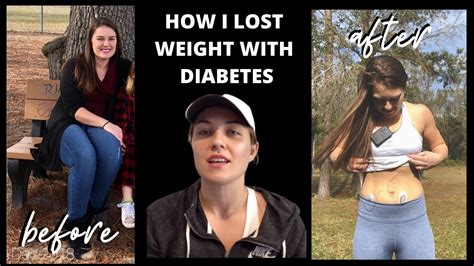 how to lose weight as a type one diabetes