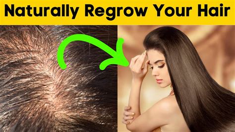 Page not found My Blog Regrow hair naturally, Hair loss remedies