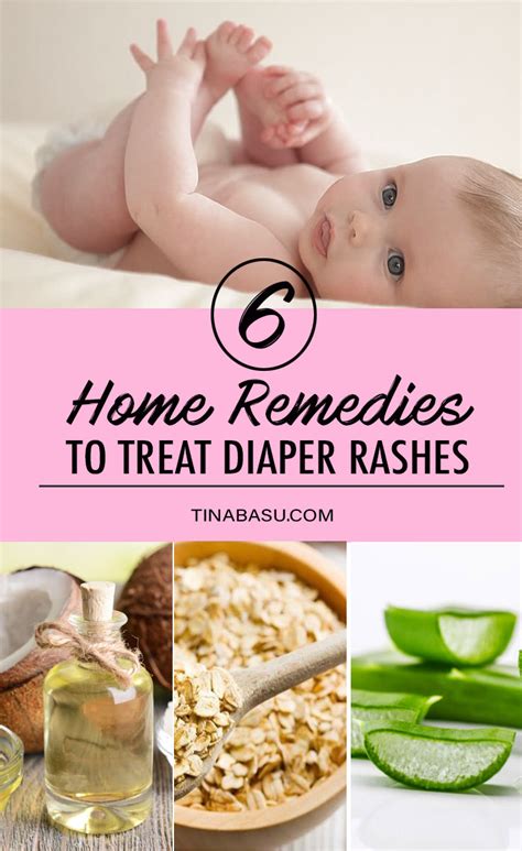 4 Easy Ways to Relieve Diaper Rash Fast wikiHow