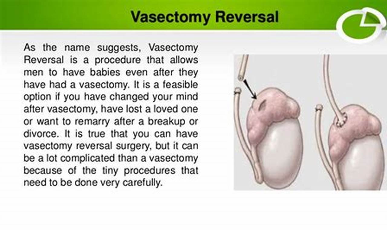 how to reverse a vasectomy