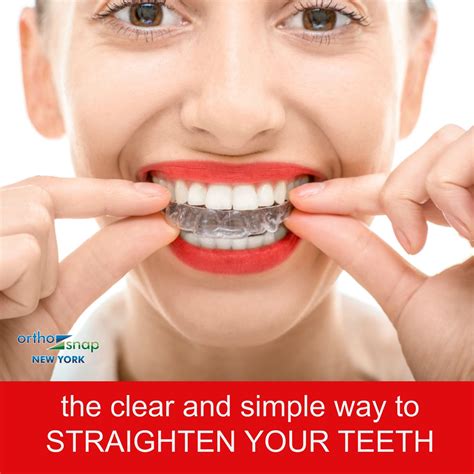 How To Straighten Teeth Without Braces At Home In Hindi TeethWalls
