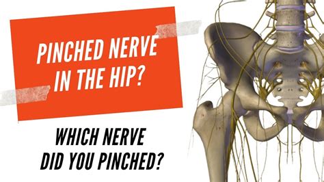 How To Treat A Pinched Nerve In The Hip