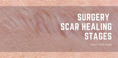 How To Treat A Scar From Surgery: Tips And Tricks