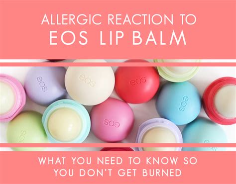 How To Treat Allergic Reaction To Lip Balm