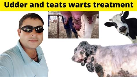 How To Treat Cattle Warts