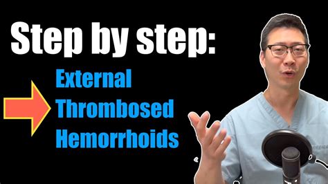 How To Treat External Thrombosed Hemorrhoids