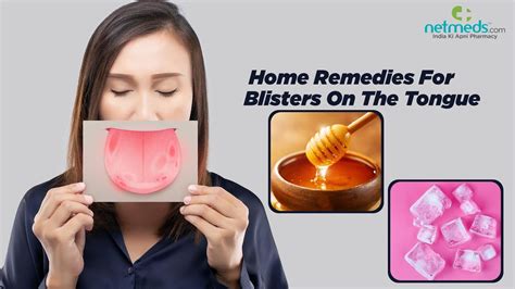How To Treat Tongue Blisters: A Comprehensive Guide