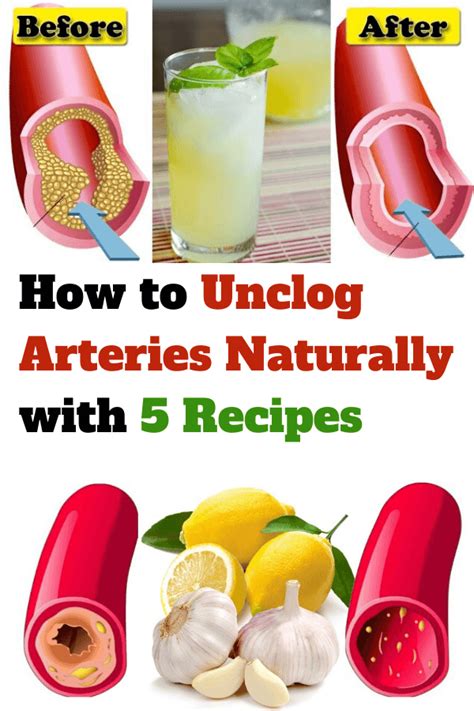21 Foods That Naturally Unclog Arteries in 2020 Foods for heart