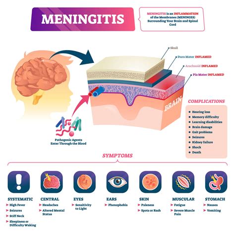 how bacterial meningitis spreads