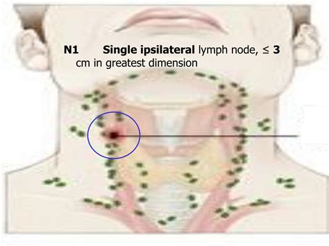 How Big Is 3 Cm Lymph Node