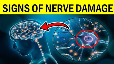 How Brain Nerve Damage Happens And What To Do Next
