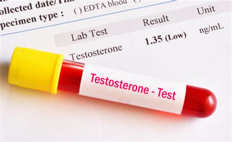 How Can Testosterone Levels Be Checked
