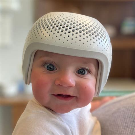 How Common Are Helmets For Babies