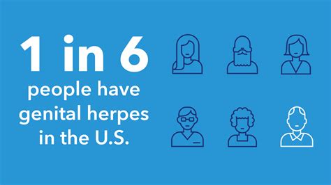 how common is hsv 1 in the us