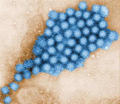 how common is the norovirus