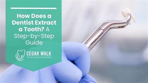 Tooth extraction Dental Health Associates