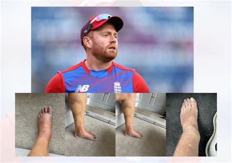 how did bairstow break his leg