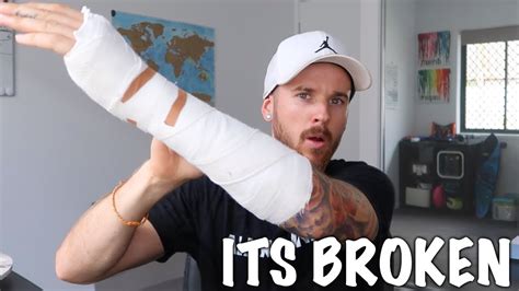 how did mack break his arm
