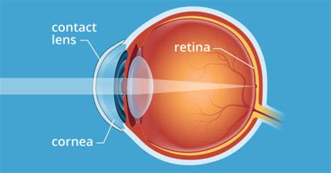 How Do Contacts Work
