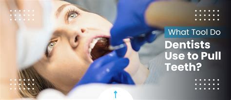 Watch as Dentist Extracts His Own Wisdom Tooth in Viral Video Allure