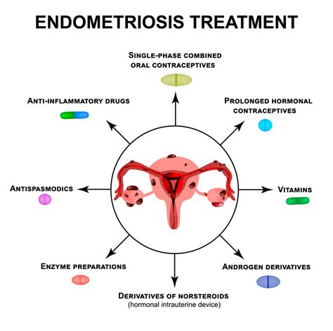 how do doctors treat endometriosis