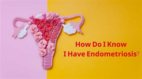 how do i find out if i have endometriosis