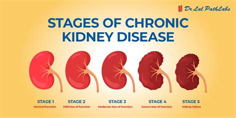 How Do Kidneys Get Bad Understanding The Causes