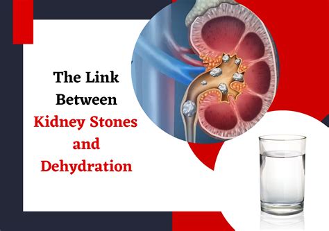 How Do Kidneys Get Dehydrated: Hidden Causes And Symptoms