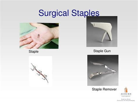 How Do Staples Work In Surgery