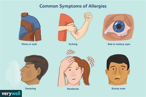 how do you feel after a severe allergic reaction