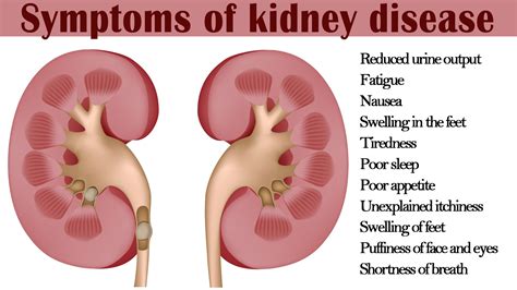How Do Your Kidneys Fail: Causes And Early Warning Signs