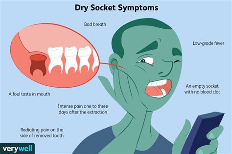 Healing Dry Socket Your Guide Dental Aware Australia