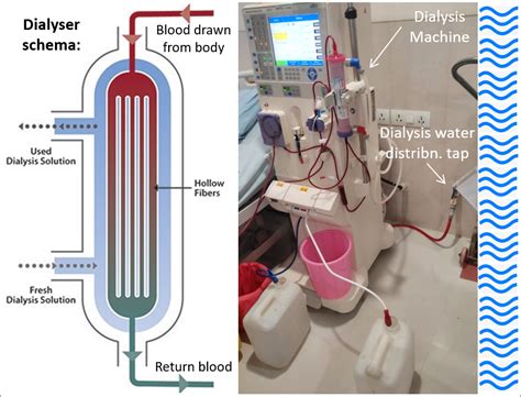 How Does A Dialysis Water System Work