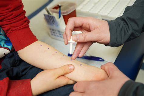 How Does Allergy Testing Work On Babies