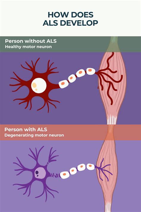 how does als cause death