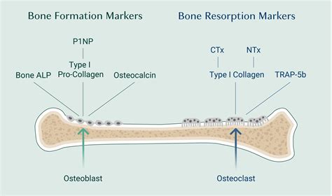 How Does Bone Radiol Work