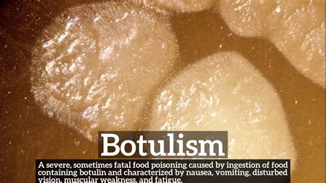how does botulism get in food