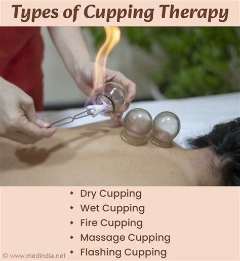 Cupping Therapy Works