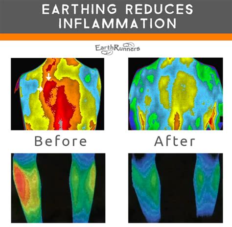 How Does Earthing Reduce Inflammation