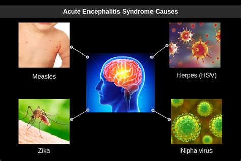 how does hsv cause encephalitis