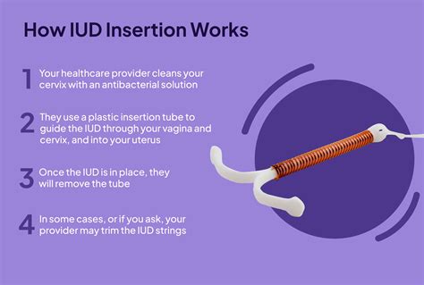 how does iud prevent pregnancy