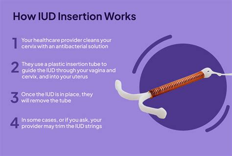 Understanding IUDs: How Does IUD Work for Contraception?