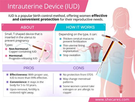 how does iud work to prevent pregnancy