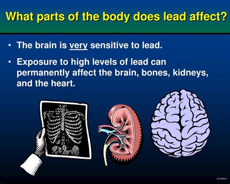 How Does Lead Affect The Brain In General