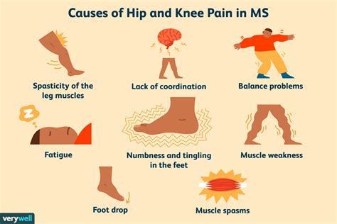 how does ms affect your legs