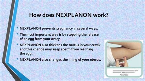 Understanding Nexplanon: How Does Nexplanon Work for Birth Control