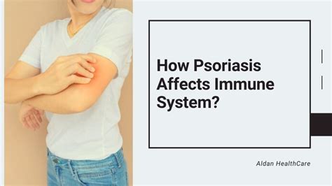 how does psoriasis affect the immune system